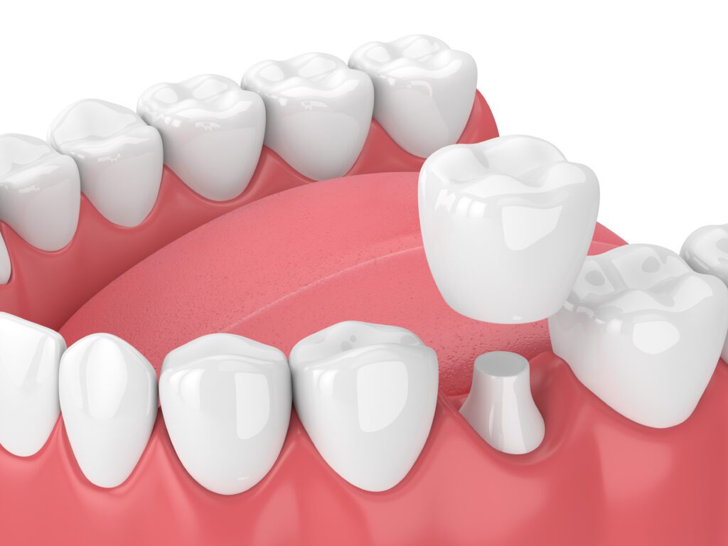 Mesa Dental Group -